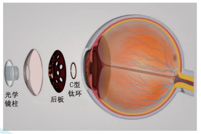 图片包含 图示描述已自动生成