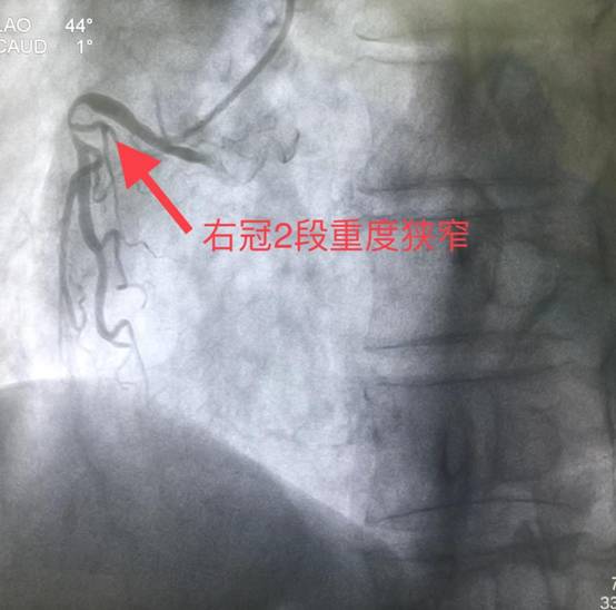 微信图片_20230222150915